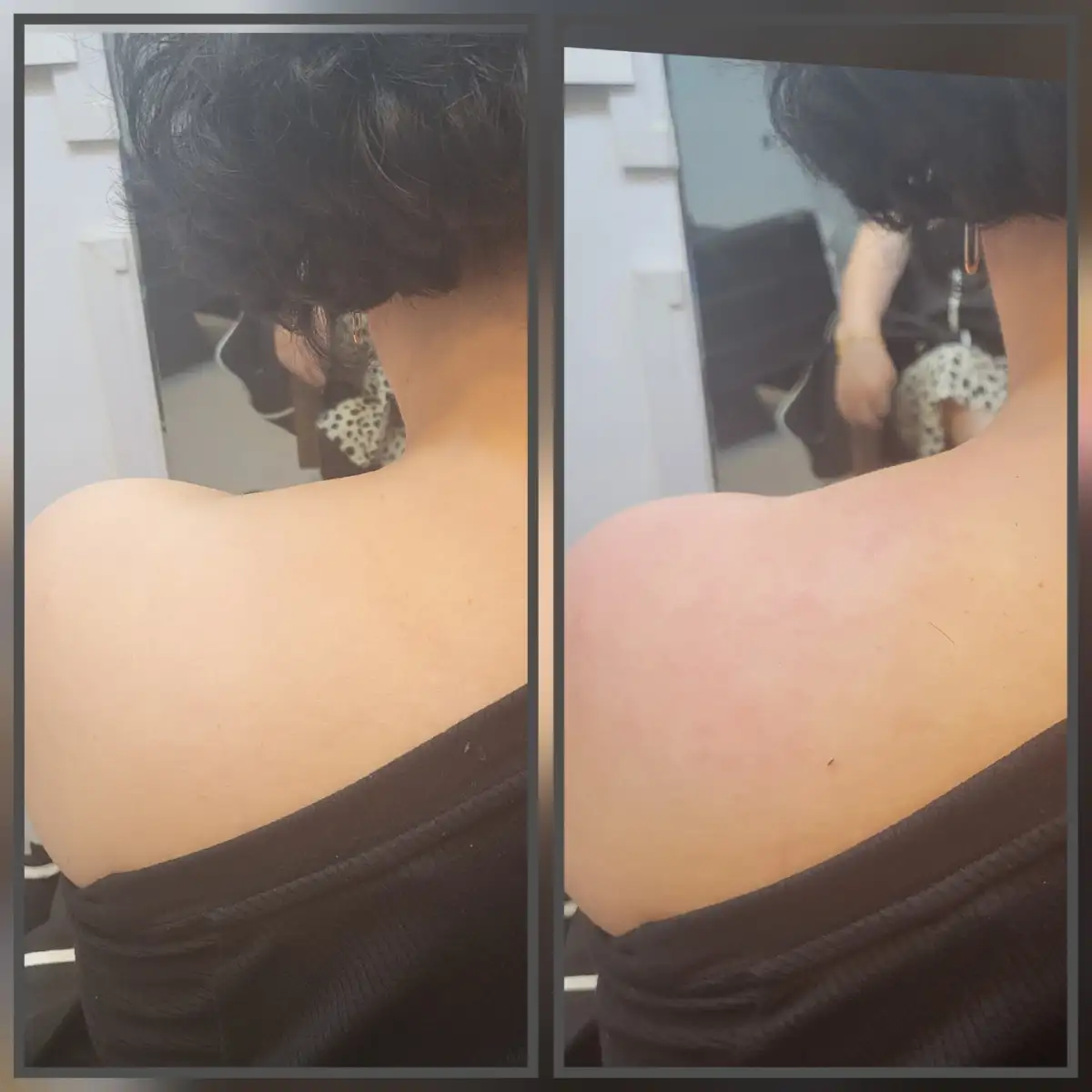 통증관리+림프관리